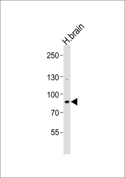 ANKRD20A8P Antibody (Center)