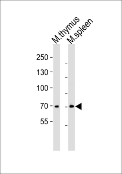 Mouse Itk Antibody (N-term)