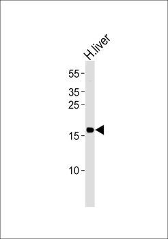 GLRX5 Antibody (Center)