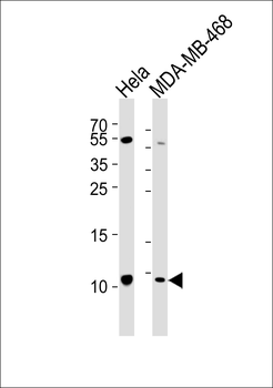 SNRPG Antibody (N-term)
