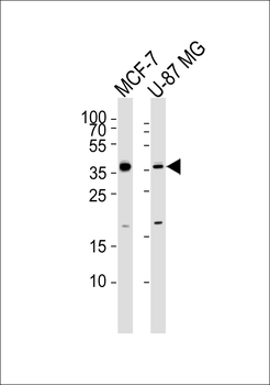 KCTD4 Antibody (Center)