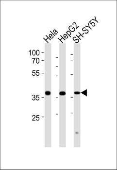 TIMM50 Antibody (N-term)