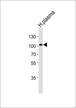 GSN Antibody (N-term)