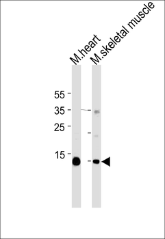 Myoglobin Antibody (C-term)