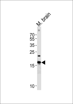 CPLX2 Antibody (Center)