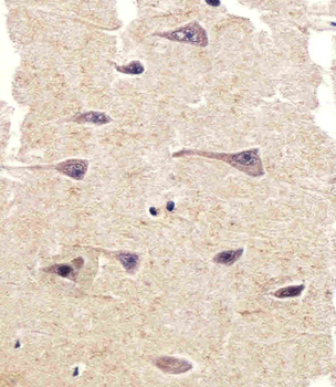 PTK2B Antibody (C-term)