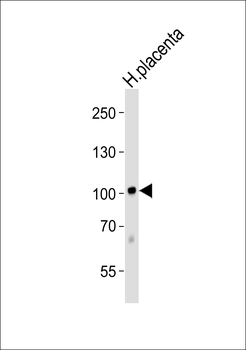 LEPRE1 Antibody (Center)