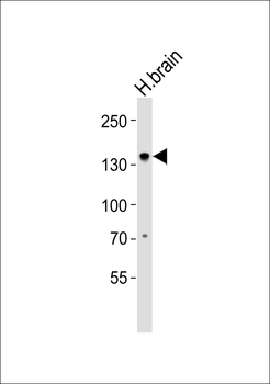 OVOS1 Antibody (Center)