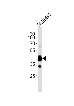 LDB3 Antibody (N-term)