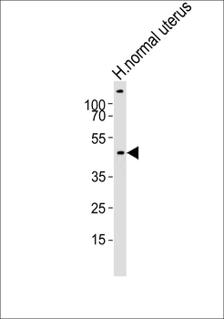 CERKL Antibody (N-term)