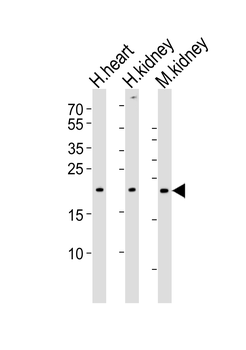 CYS1 Antibody (C-term)