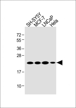 PARK7 Antibody (C-term)