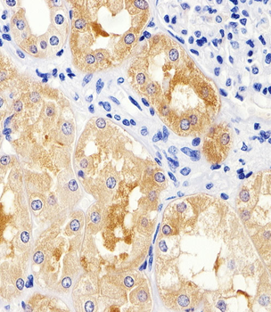 MAD2L2 Antibody (C-term)