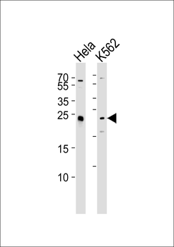 MAD2L2 Antibody (C-term)