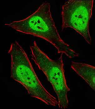 MAD2L2 Antibody (C-term)