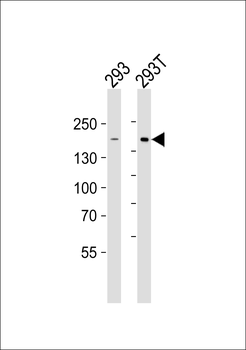 DIAPH1 Antibody (N-term)
