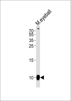 GNGT1 Antibody (C-term)