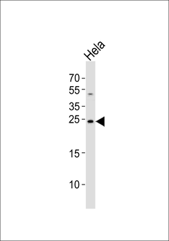 CDKN1A Antibody (C-term)
