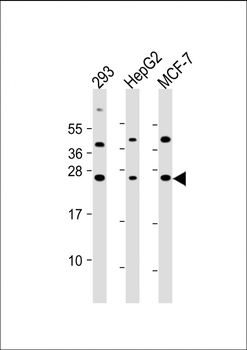 CDKN1A Antibody (C-term)