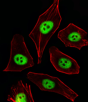CDKN1A Antibody (C-term)