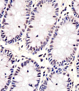 CDKN1A Antibody (C-term)