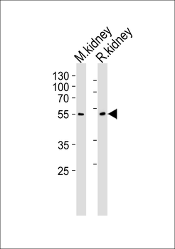 CNDP1 Antibody (Center)