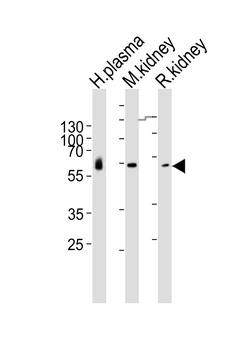 CNDP1 Antibody (Center)