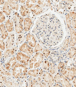 GLI2 Antibody (C-term)