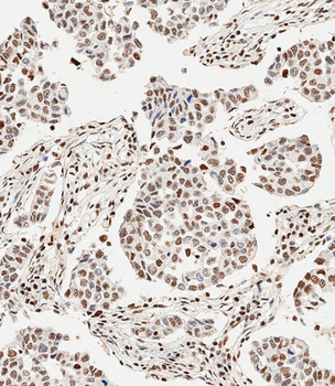 GLI2 Antibody (C-term)