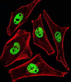 SMARCD3 Antibody (N-term)