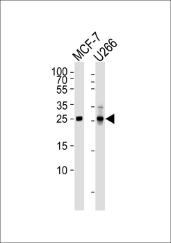 CDKN1B Antibody