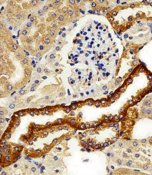 FXYD6 Antibody (C-term)