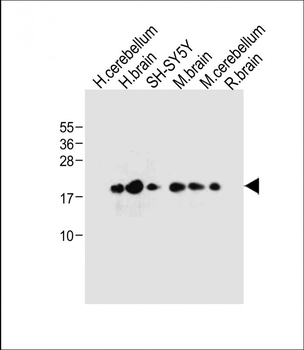 FXYD6 Antibody (C-term)