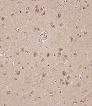 STRADA Antibody (C-term)