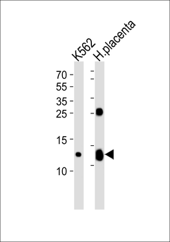 HBG2 Antibody (C-term)