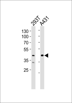CSNK2A1 Antibody (Center)