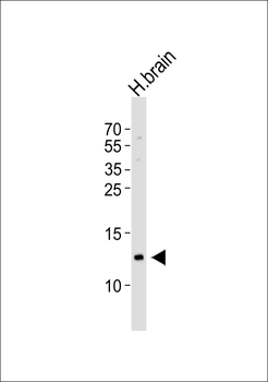 HBG2 Antibody (C-term)