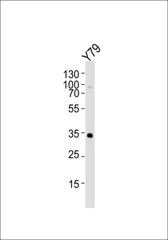OTX2 Anitbody Antibody