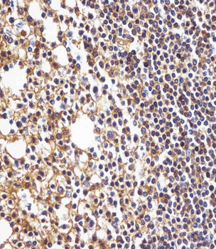 HLA-B Antibody (N-term)