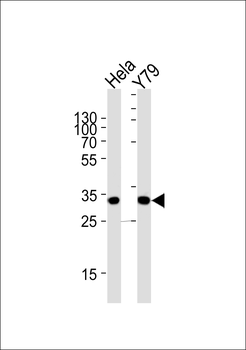 PDCL Antibody (N-term)