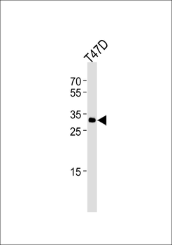 ING4 Antibody (C-term)