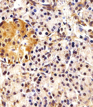 ING4 Antibody (C-term)