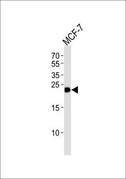 GSTM4 Antibody (N-term)