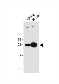 GSTM4 Antibody (N-term)