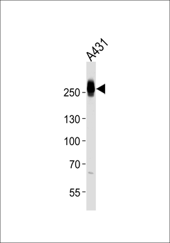 MYH14 Antibody (Center)