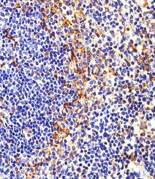 FYN Antibody