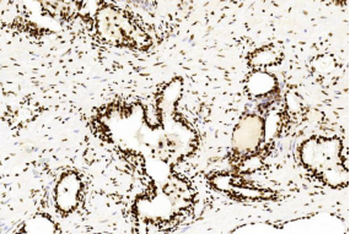 CREB1 Antibody