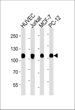 TOP1 Antibody (N-term)