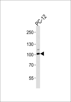 Rat Atp1a1 Antibody (N-term S23)