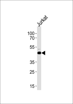 ATG4B Antibody (Center)